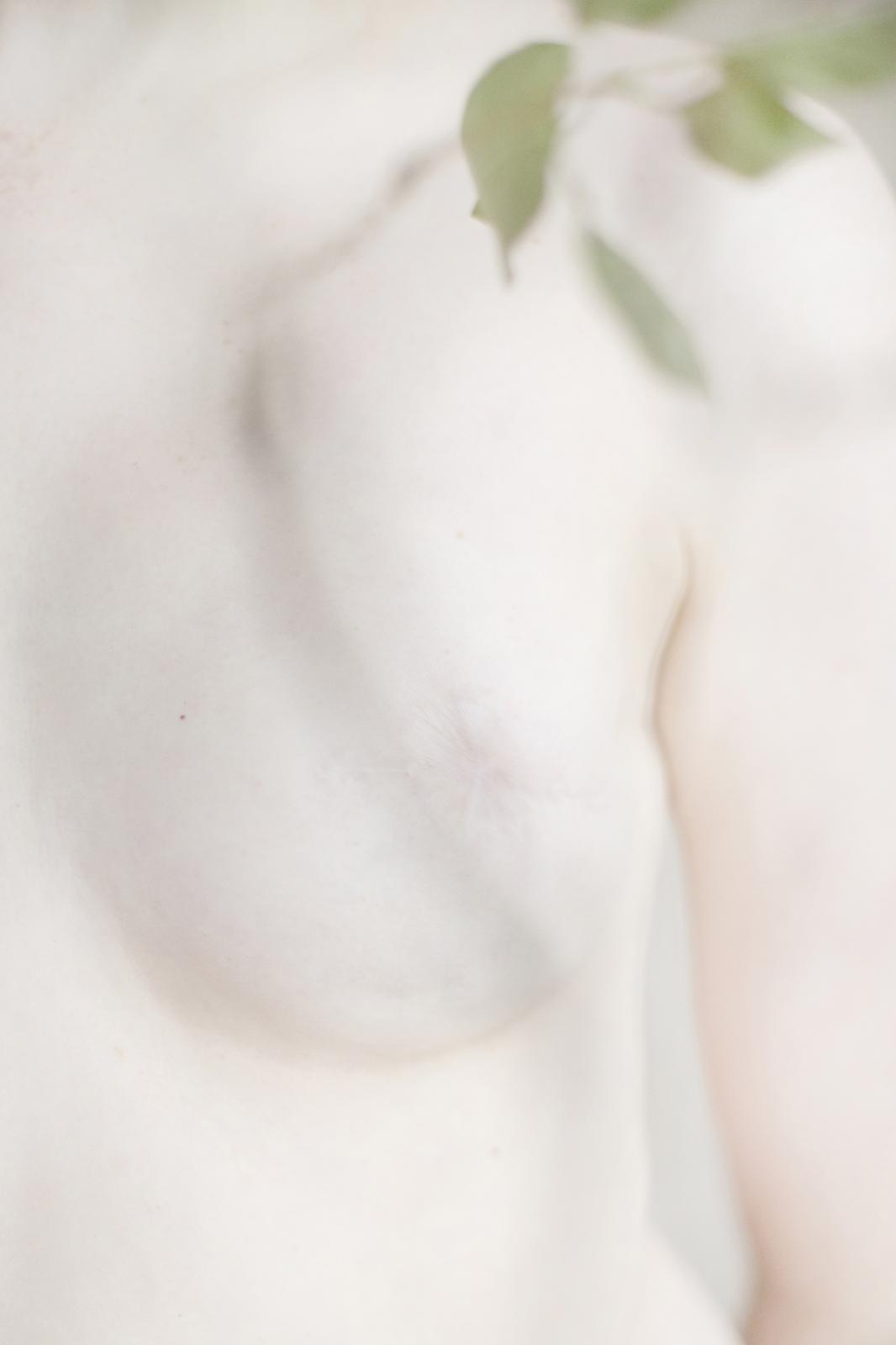 Am I Not Scared Anymore? - For most women with this diagnosis nude photography is...