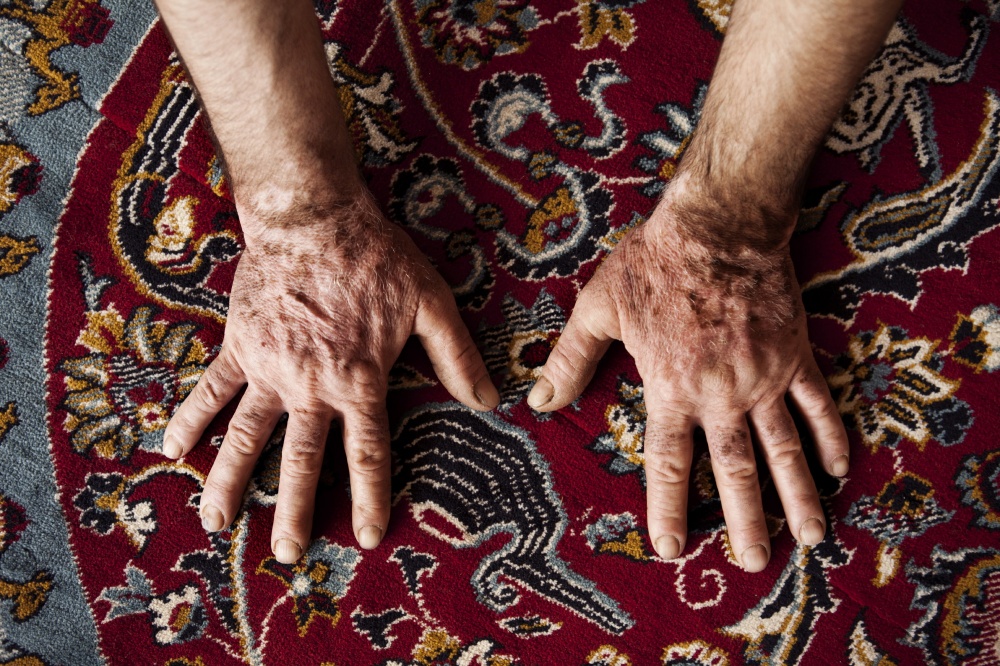 Amhed Baker's hands. He wa...ery common among the survivors.