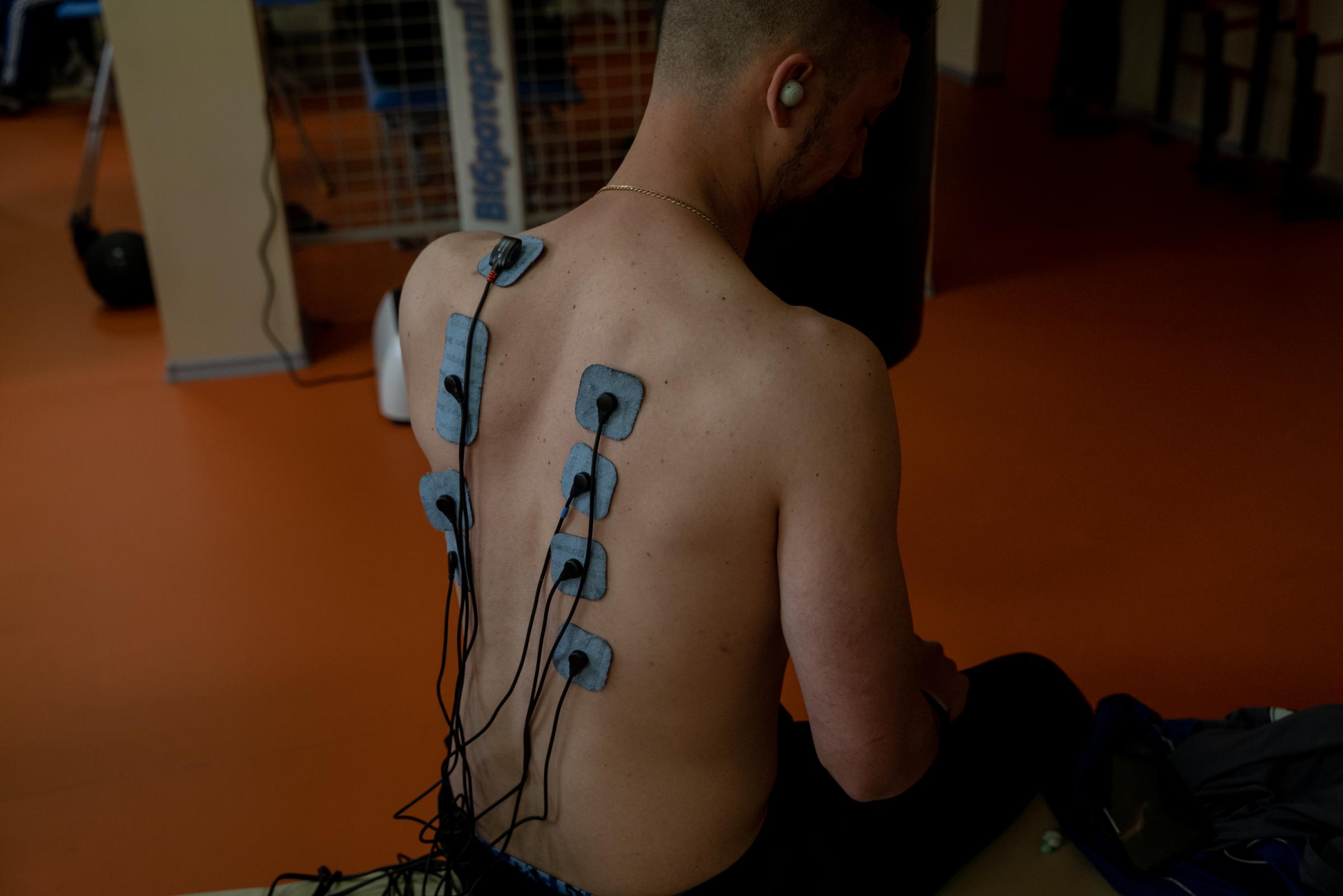 The Hidden Trauma of Ukraine's Soldiers - Dima, 28, has electrotherapy for wounds suffered in...