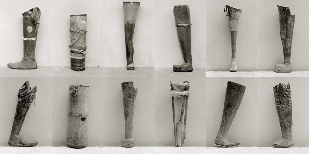 Murales, prótesis y amputados -   