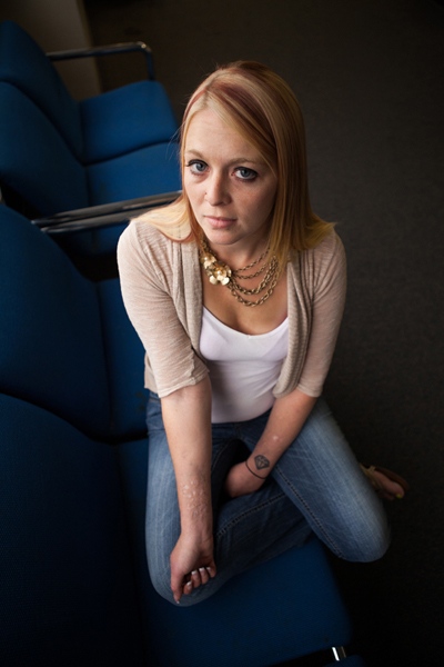    Kristin Waller, a human trafficking survivor in Columbus, Ohio, poses in the hallways of C.A.T.C.H. court, a voluntary program to recover those in the sex trade that she attends every Thursday. Here Waller shows a scar that she was given by her trafficker. Waller has applied to a Survivors Ink scholarship to get the scar covered with tattoo artwork.   