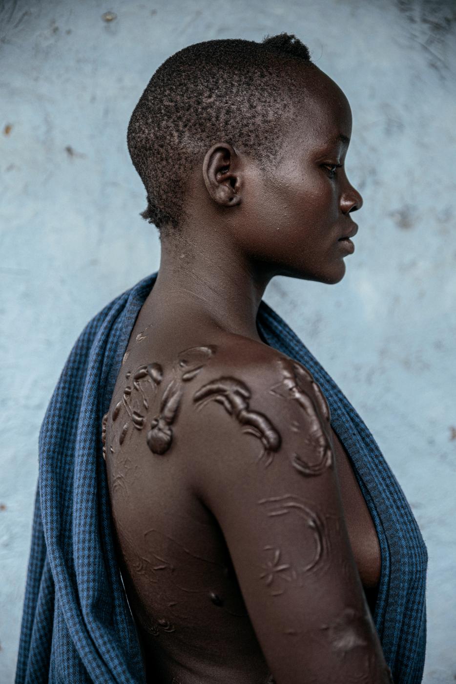 The language of scarifications: A photo essay on the Me'en tribal woman in Ethiopia