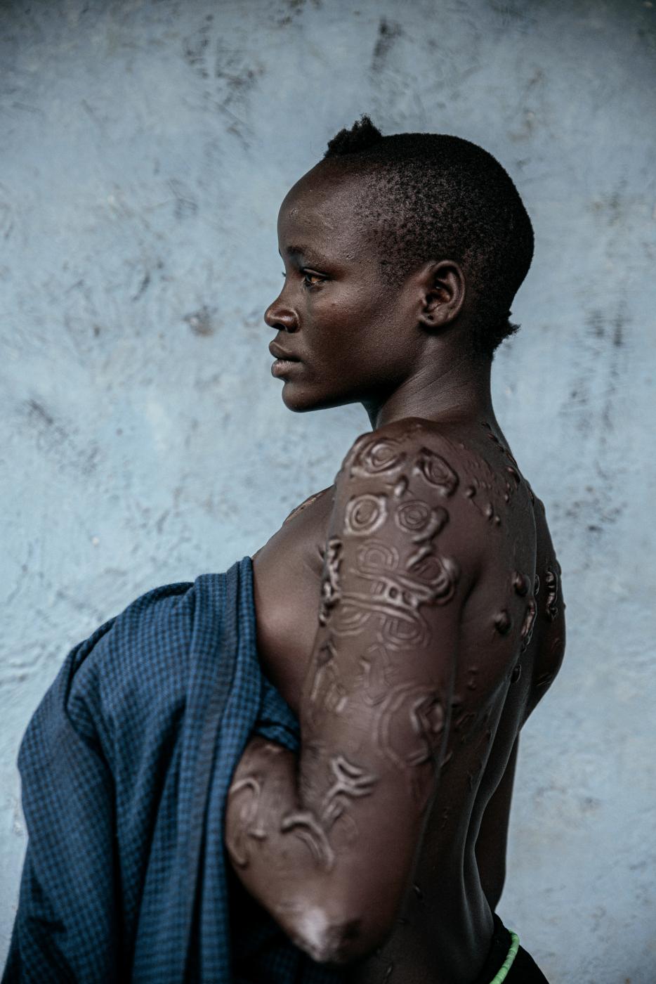 The language of scarifications: A photo essay on the Me'en tribal woman in Ethiopia