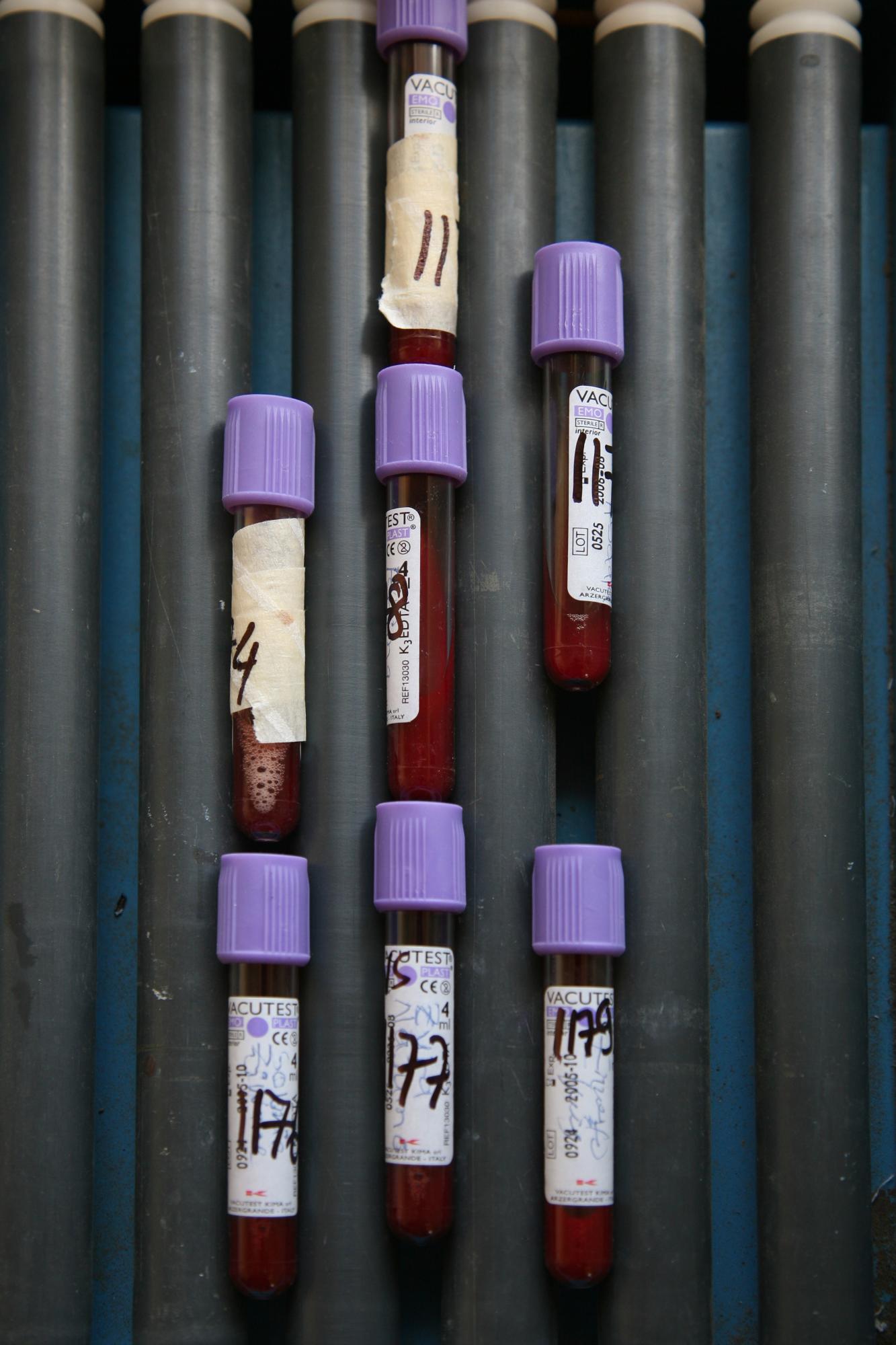 Malaria - Blood samples for testing. Mocimboa da Praia local...