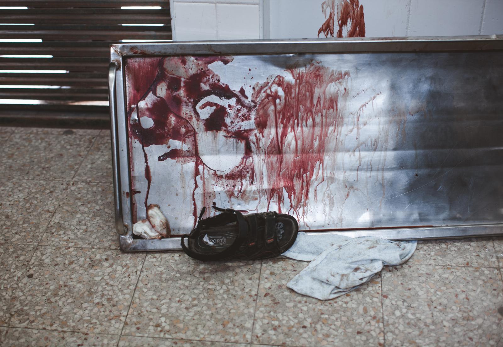 Gaza War 2014 - blood of Mazen al-Jarba, a Palestinian militant who was...