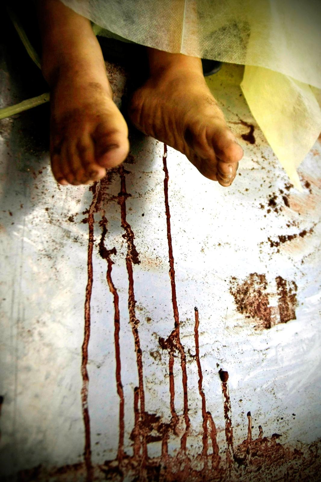 Gaza War 2008  - The feet of one of three Palestinian siblings from the...