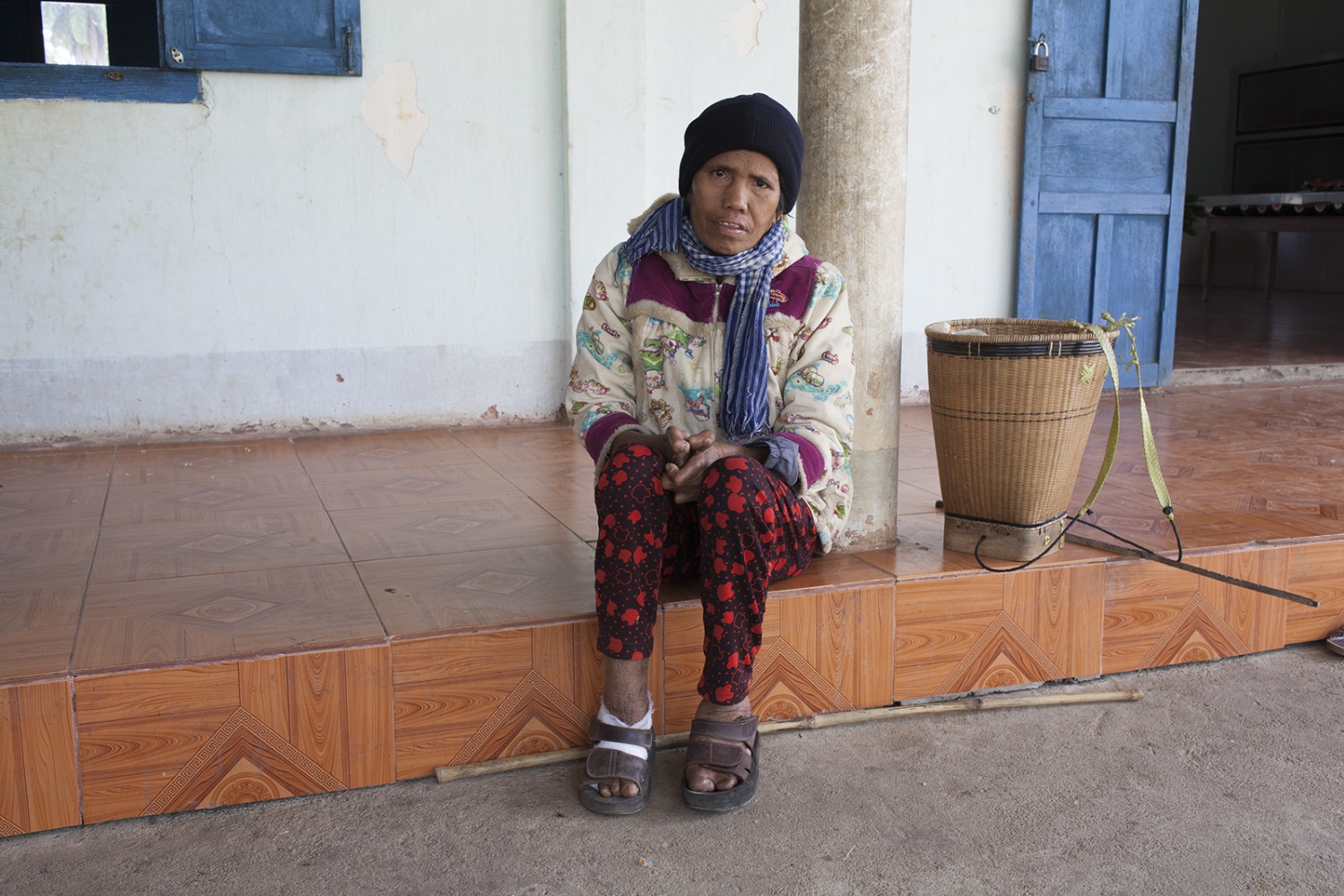  This is GlÃ¢i one of the ladies in the colony that has had the disease for a while and therefor...