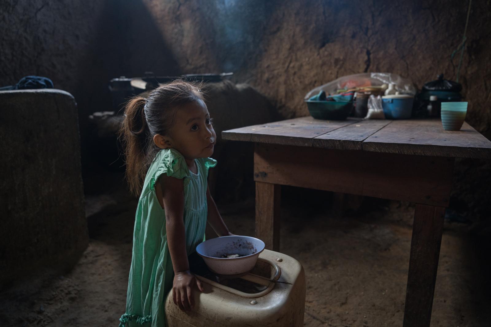 The Dry Corridor: How climate change causes mass migration from Central America - Yurixa Jimena Ramos Ram&iacute;rez (3), who suffers from chronic malnutrition, waits for her...