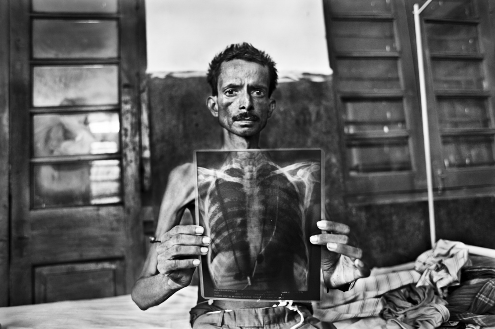 Kala Azar by David Rengel