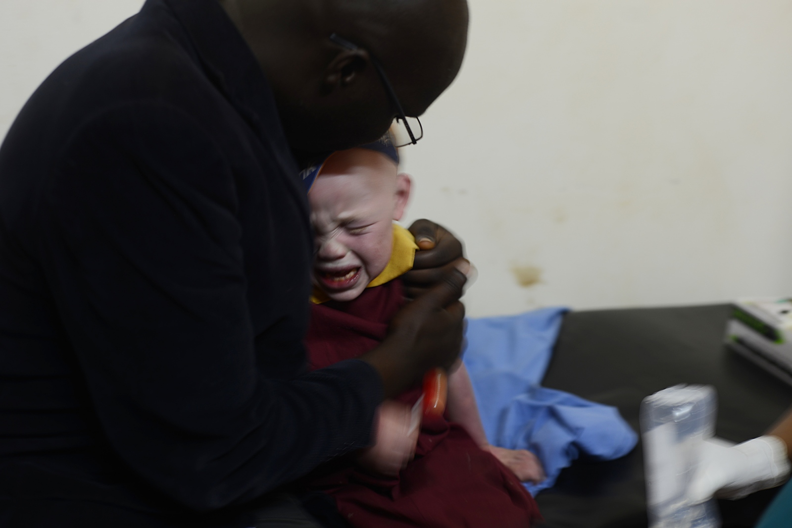 Albinism: Uganda