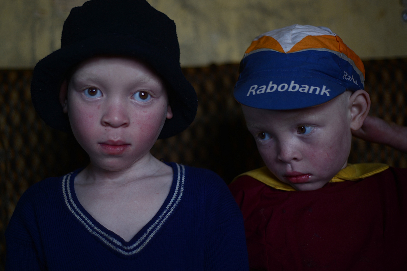 Art and Documentary Photography - Loading albinism07.JPG