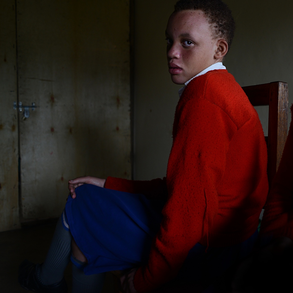 Art and Documentary Photography - Loading albinism18.JPG