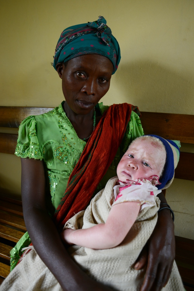 Art and Documentary Photography - Loading albinism20.JPG