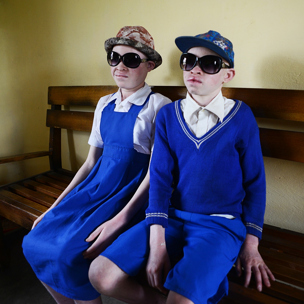 Art and Documentary Photography - Loading albinism27.JPG