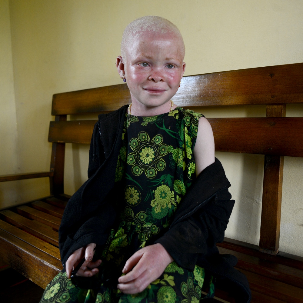 Art and Documentary Photography - Loading albinism29.JPG