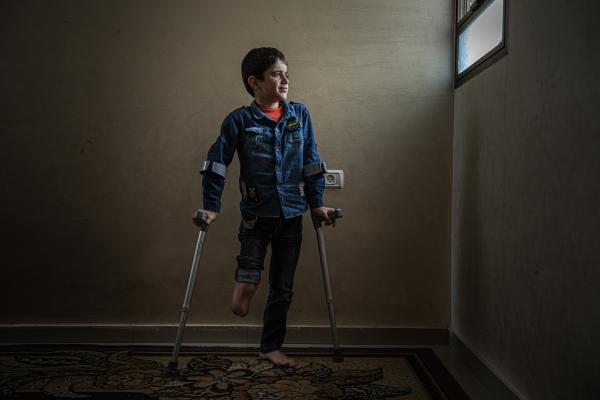 Gaza's Injured Struggle To Recover Six Months After Ceasefire - GAZA CITY, GAZA - DECEMBER 04: Saleh Humaid, 7, poses for a photo in his house in the Shujaiya...