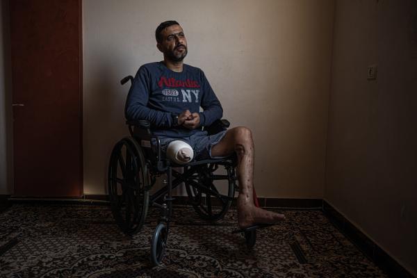 Gaza's Injured Struggle To Recover Six Months After Ceasefire - GAZA CITY, GAZA - NOVEMBER 30: The barber Muawiya Al-Wahidi, 42, poses for a photo in his house...