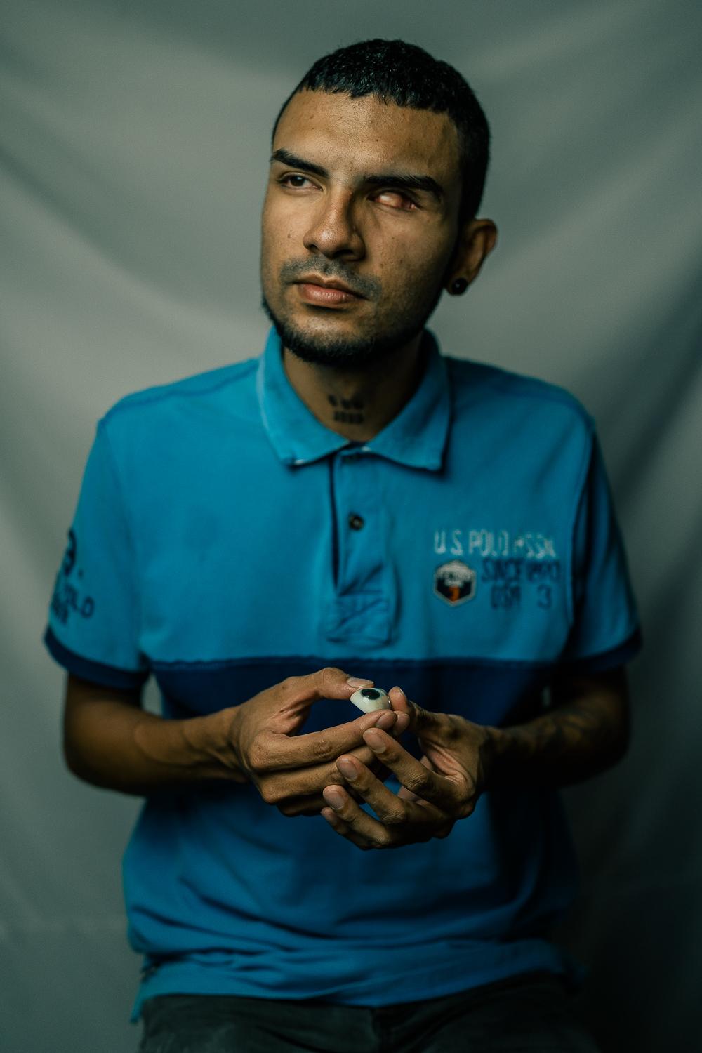 The Washington Post: Resistencia  - Giovanny poses with his prosthetic eye in Cali, Colombia.  In April of 2021, Giovanny lost his...
