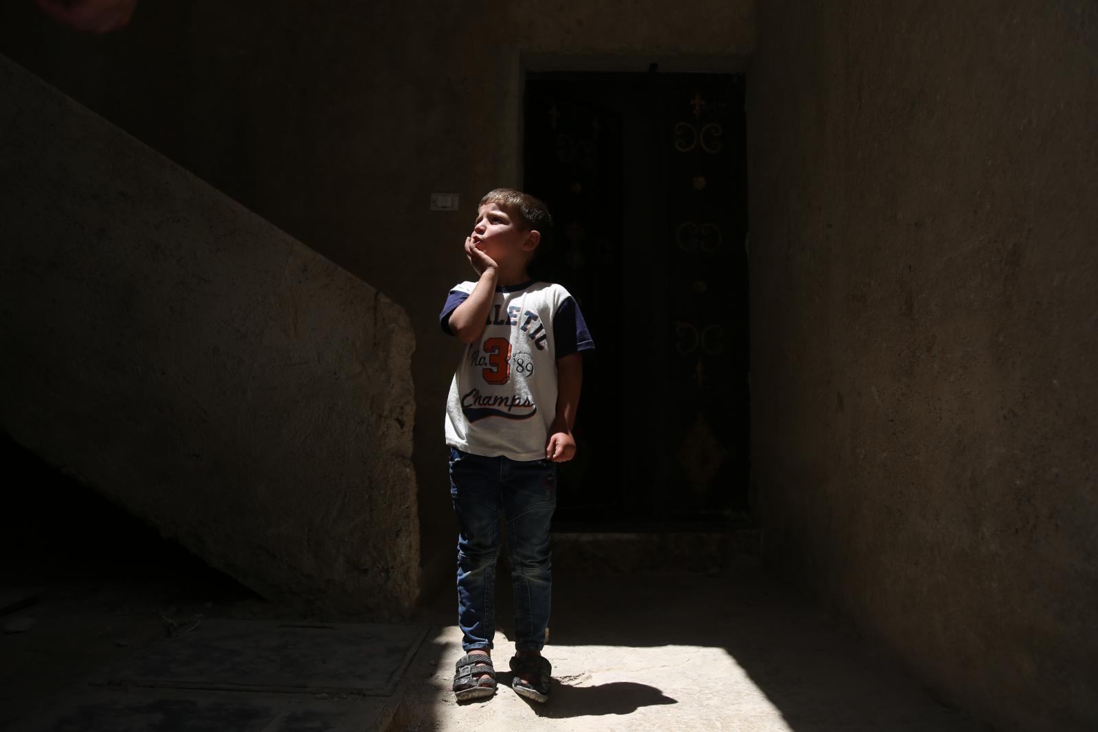 Ibrahim, a 5-year-old boy with ...ia, Idlib, Syria. June 6, 2022.