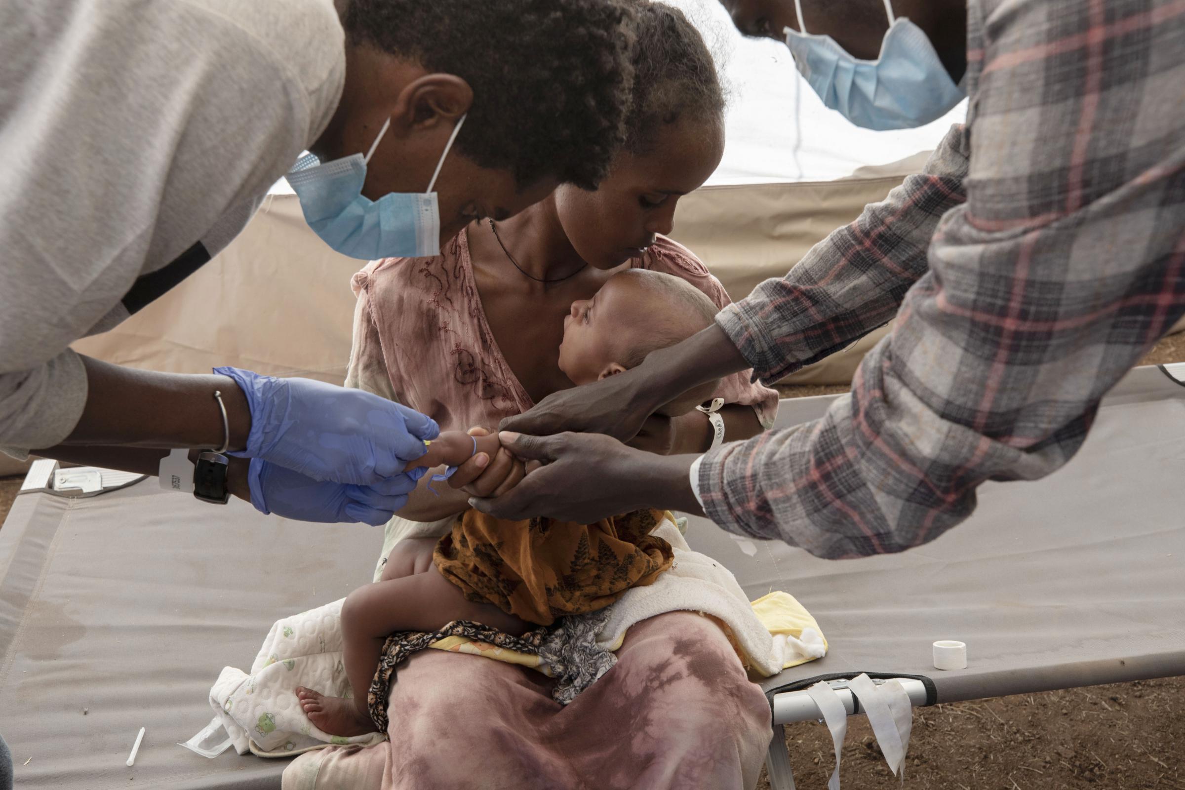 A mother holds her malnourished and severely dehydrated baby as nurses give him IV fluids, at the Medecins Sans Frontieres (MSF) clinic, at Umm Rakouba refugee camp.