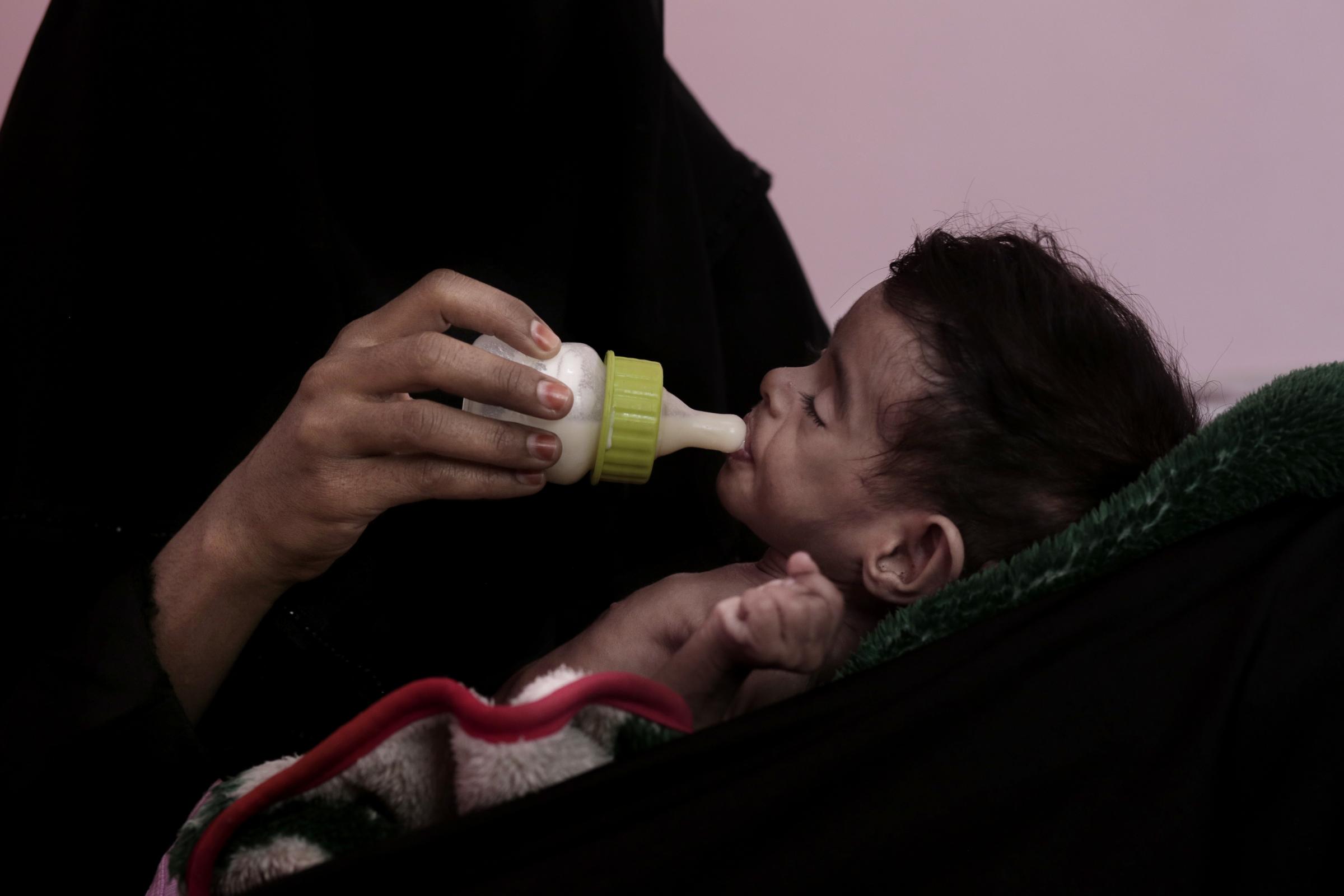 Starving Yemen mothers skip meals to save their children -  Ahmed Rashid Mokbel   Age: 7 months   Weight: 3.3 kg 