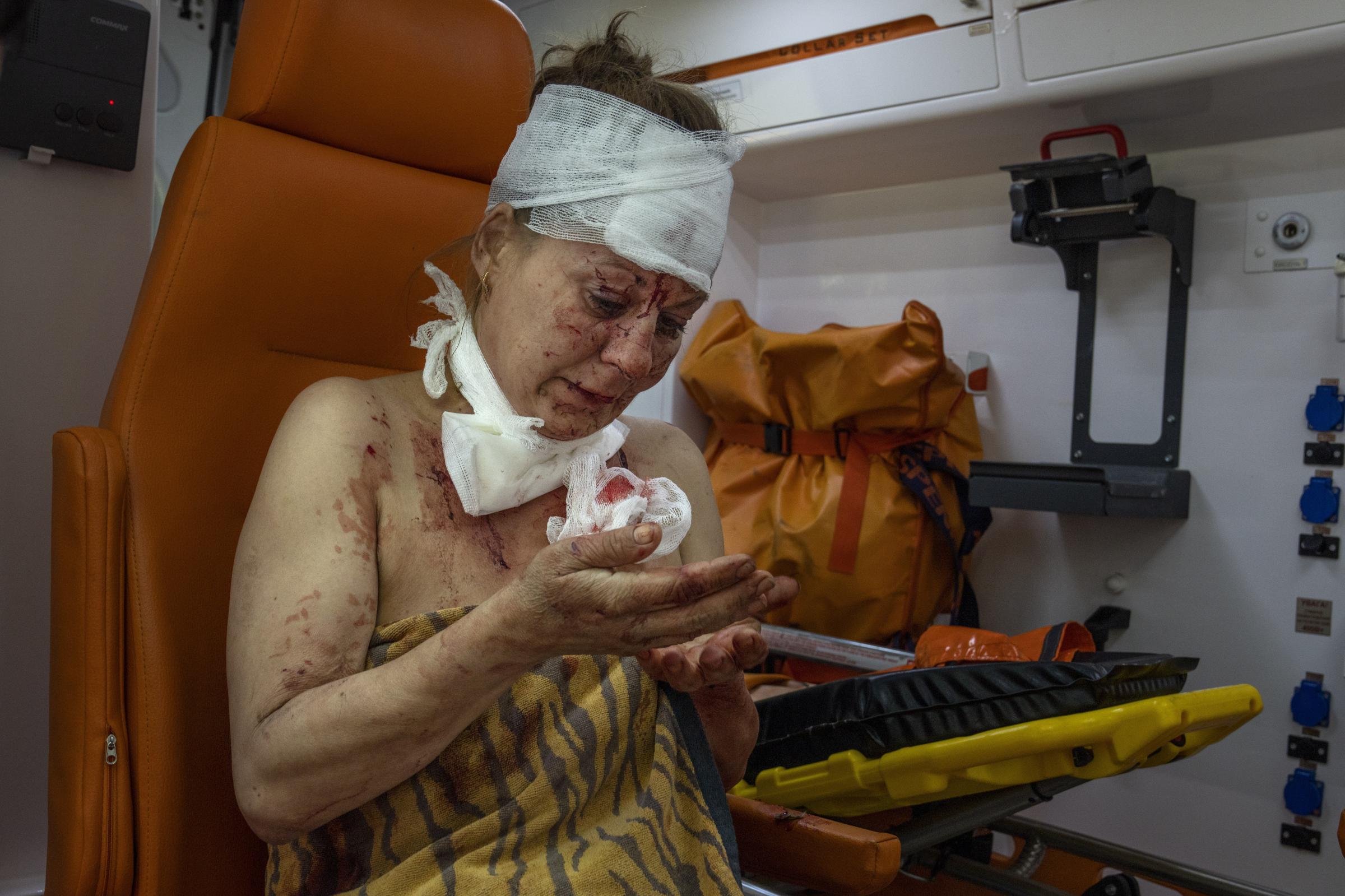 Missile strike hits eastern Ukraine's Kramatorsk -  An injured woman looks at her wounds in an ambulance...