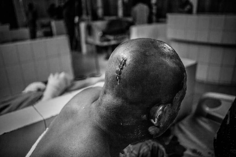  A victim of political violence..., Bangladesh, 29 January 2015. 