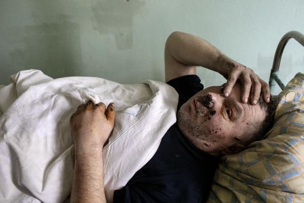 Image from Ukraine-Russia War -  Yevgeni (50), was injured while driving his car away...