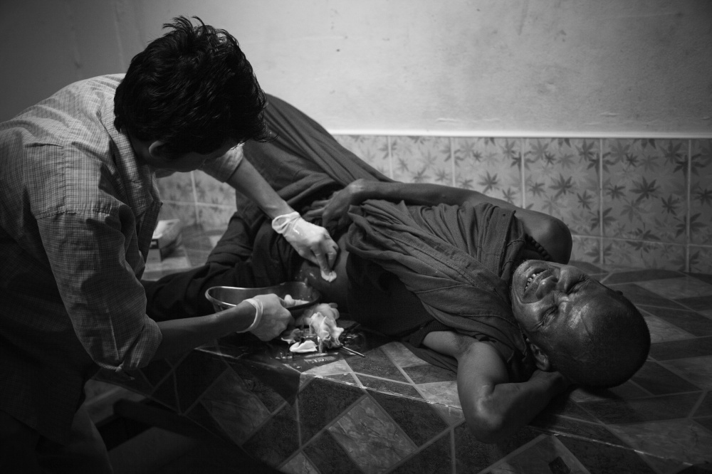 A burmese monk gets surgical treatment of an infected wound.