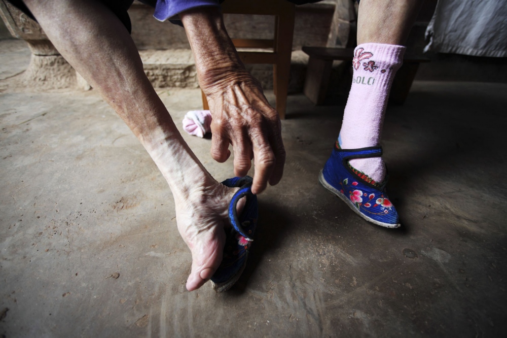 An old lady takes off her shoes exposing her tiny bound &#39;lotus&#39; foot. In a remote part of the province several villages still have the last remaining women who still have bound feet. Now very old, they are the last reminder of this ancient Chinese traditional. Yunnan Province, China.