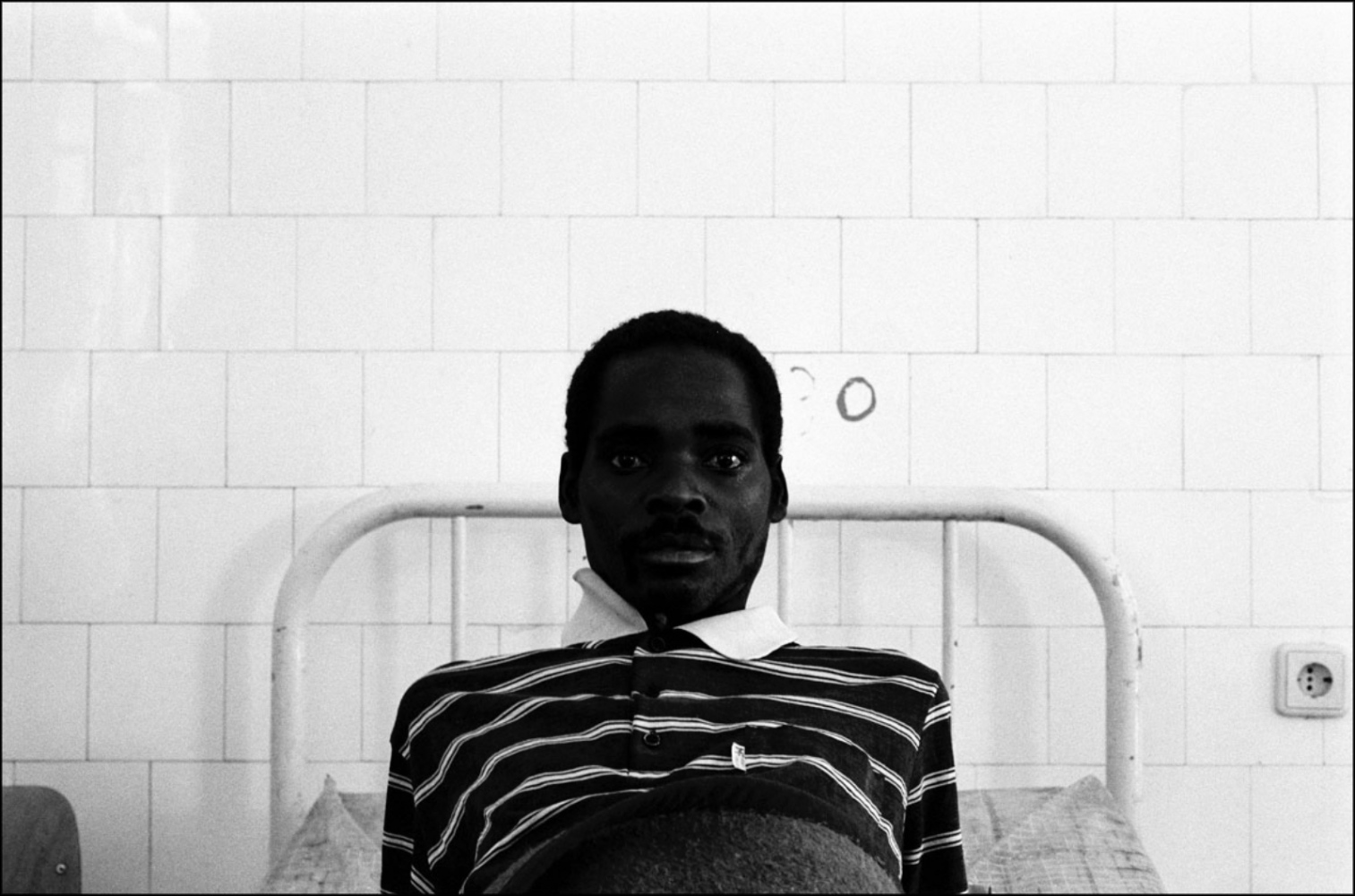 Angola's Civil War -  Stoic Patient, ICRC Hospital, Huambo, Angola, July 2000 
