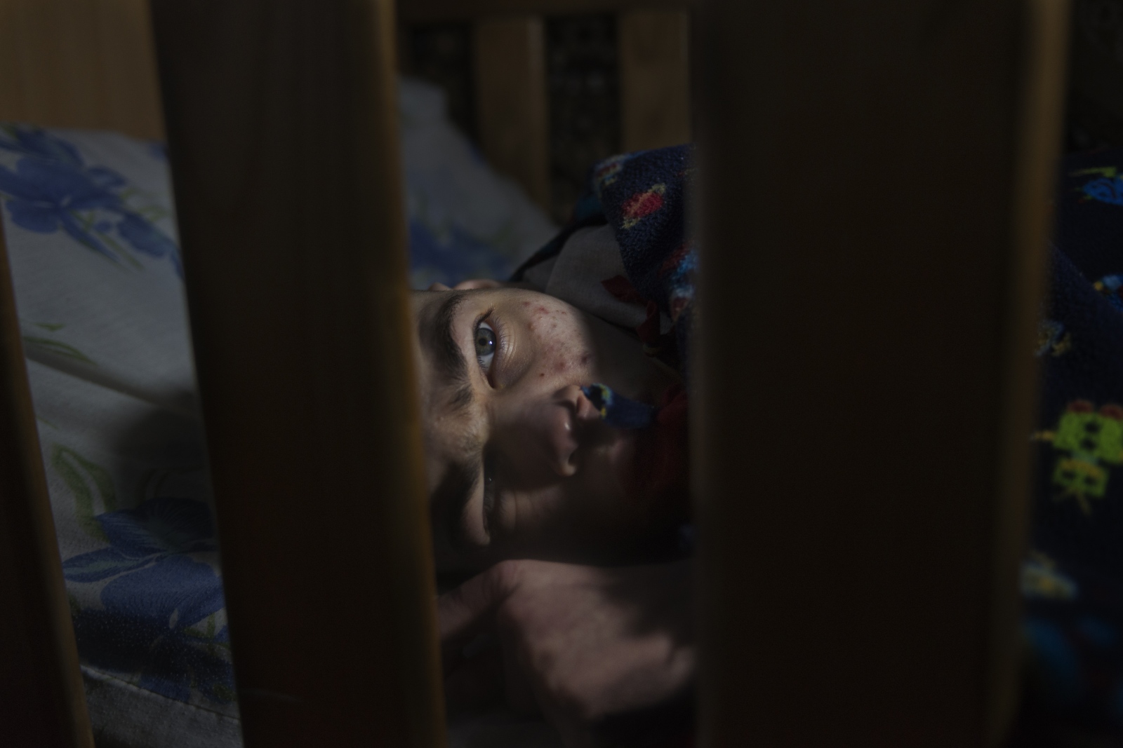 Pitomnik: Ukraine's forgotten - This 19 year old boy spends his entire life in bed. He...