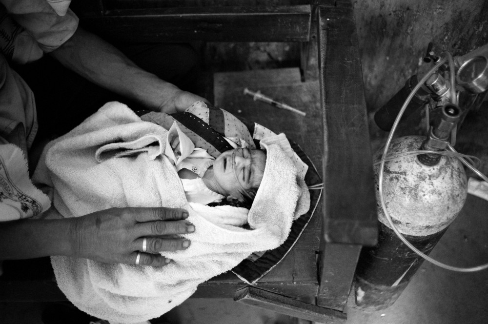 A newborn receiving oxygen on a...itions. Kandiaro, Pakistan 2010