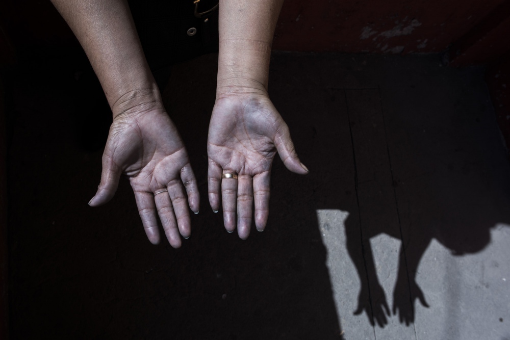 Blue-colored hands of a worker after a usual working day. 