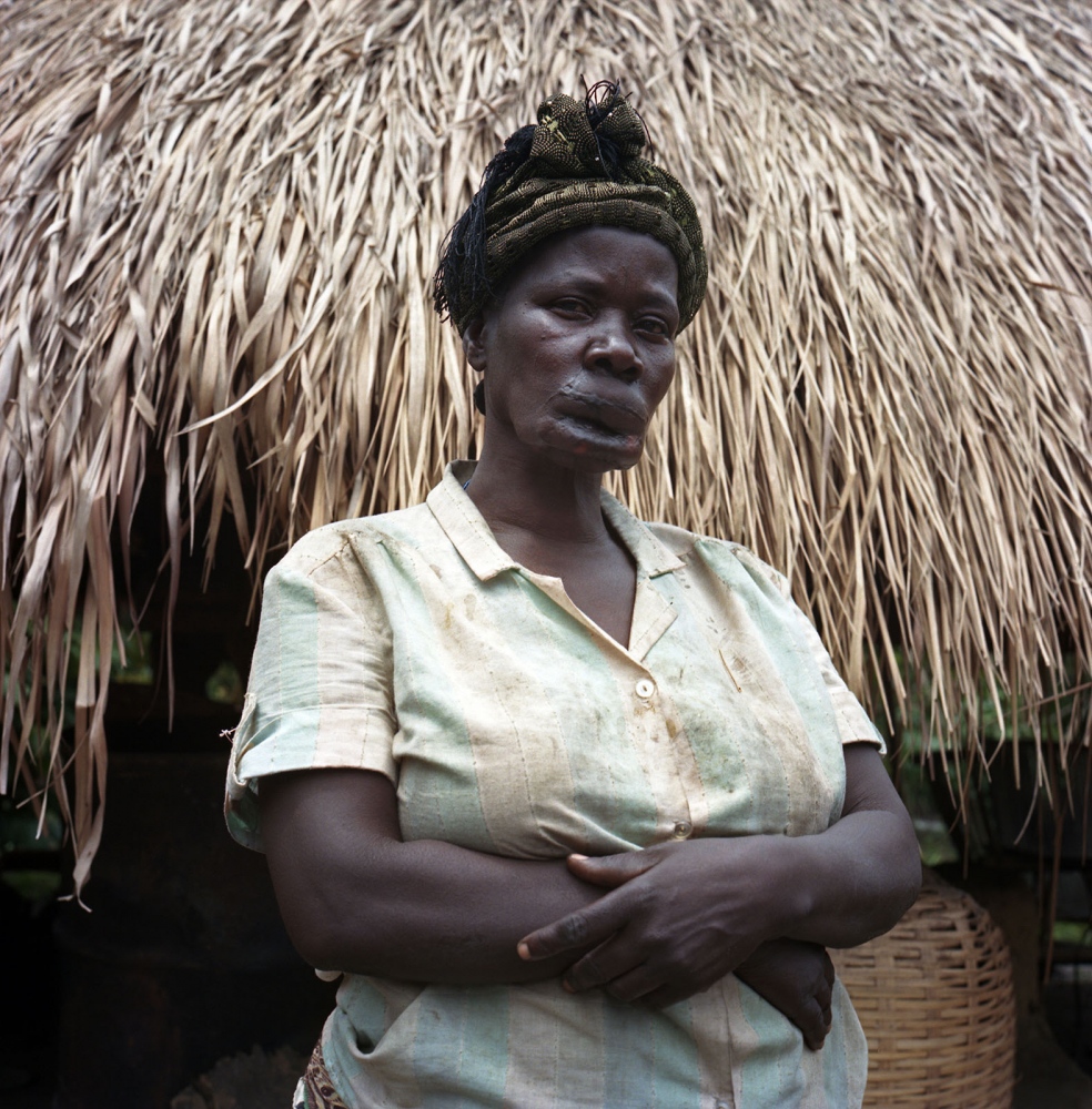 Courage in the Congo -  Jean, 55 y.o. was abducted by the LRA and mutilated. One...