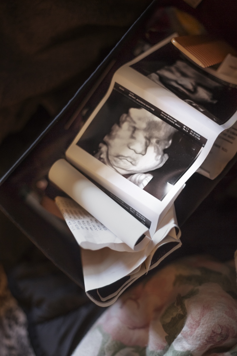 A Visceral Sense -     A 3d sonogram of Jaquahna's baby lies on her bed....