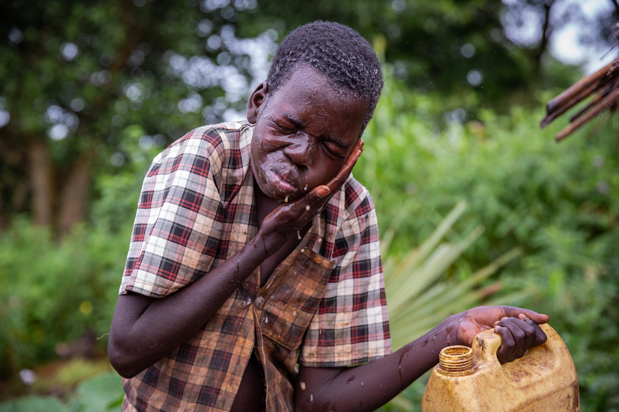 A Mysterious Fate: Nodding Syndrome in Northern Uganda
