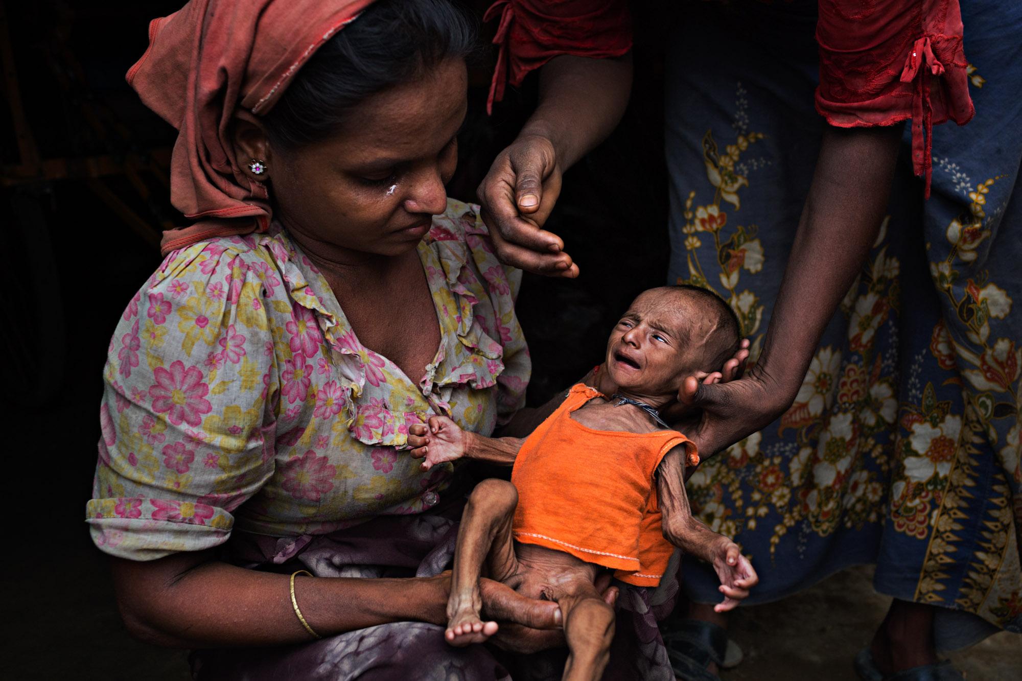  A Rohingya woman cries while holding her severely malnourished child in a refugee camp in Sittwe, Myanmar, May 2014. At this time, the Myanmar...