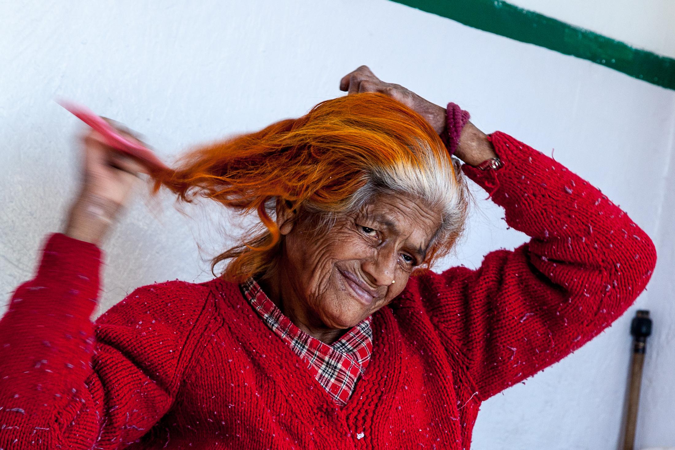 The Forgotten - LELE, NEPAL - JANUARY 24: A patient affected by leprosy...
