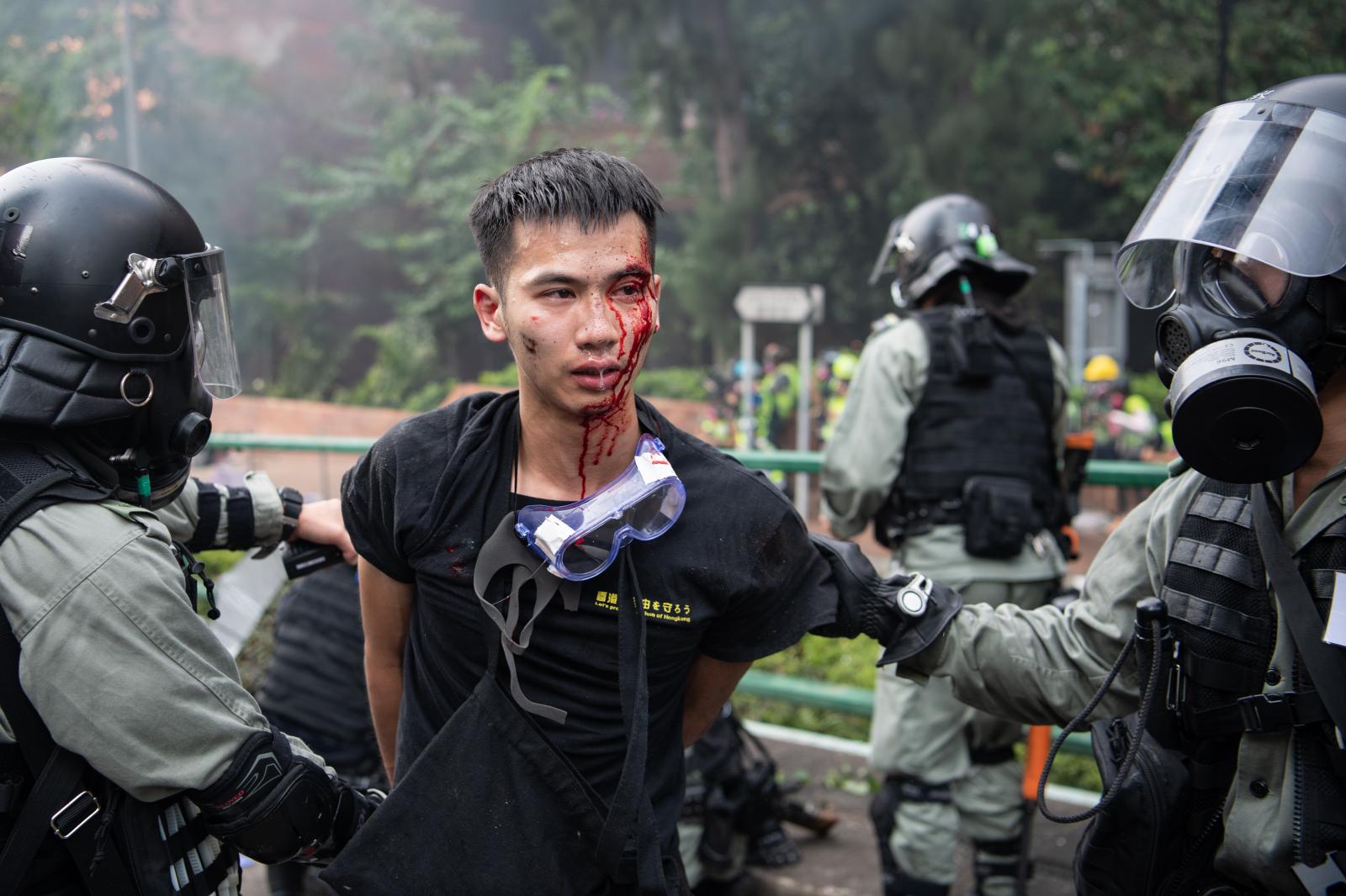 The Siege of PolyU - HONG KONG, CHINA - NOVEMBER 18: Police arrest...