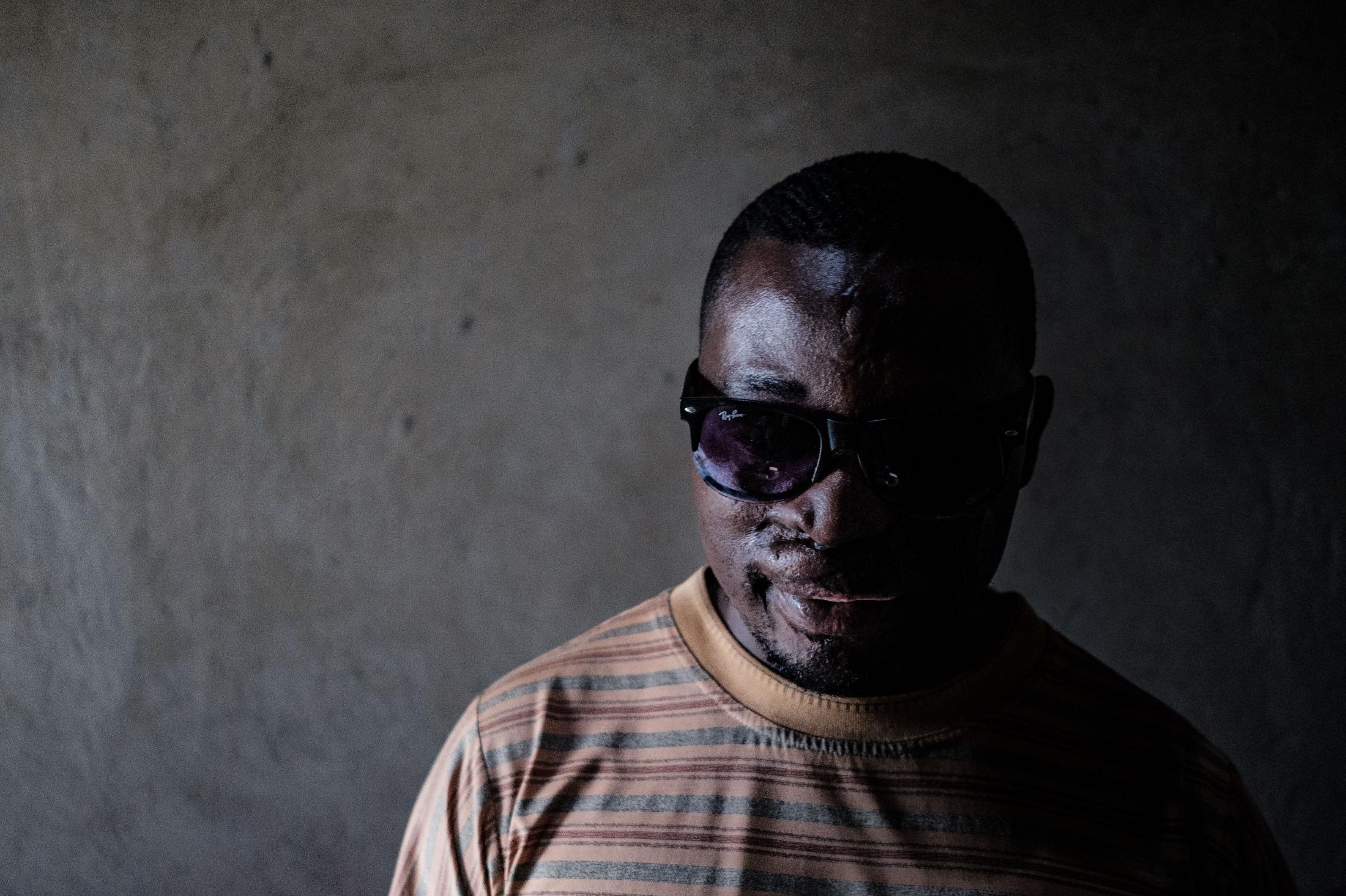 Uganda's acid attack survivors live on
