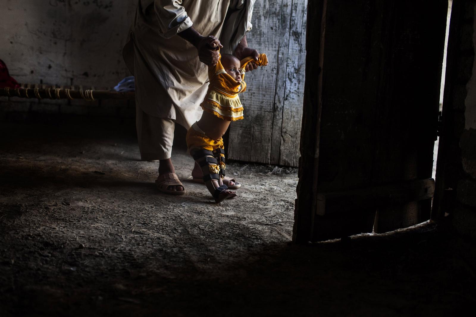 War on Polio - Saiful Islam is seeing while he is playing with his...