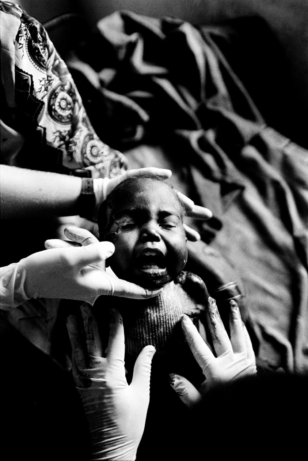 Darfur - SUDAN Golo, Darfur Doctors treating a wounded boy in Golo...