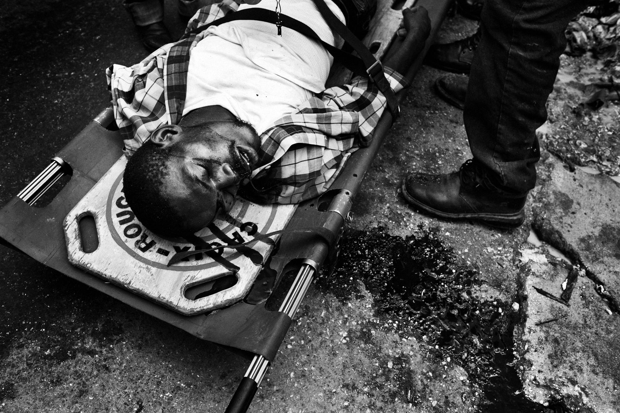 Private hell - Port au Prince.June 2010.An injured man that had a...