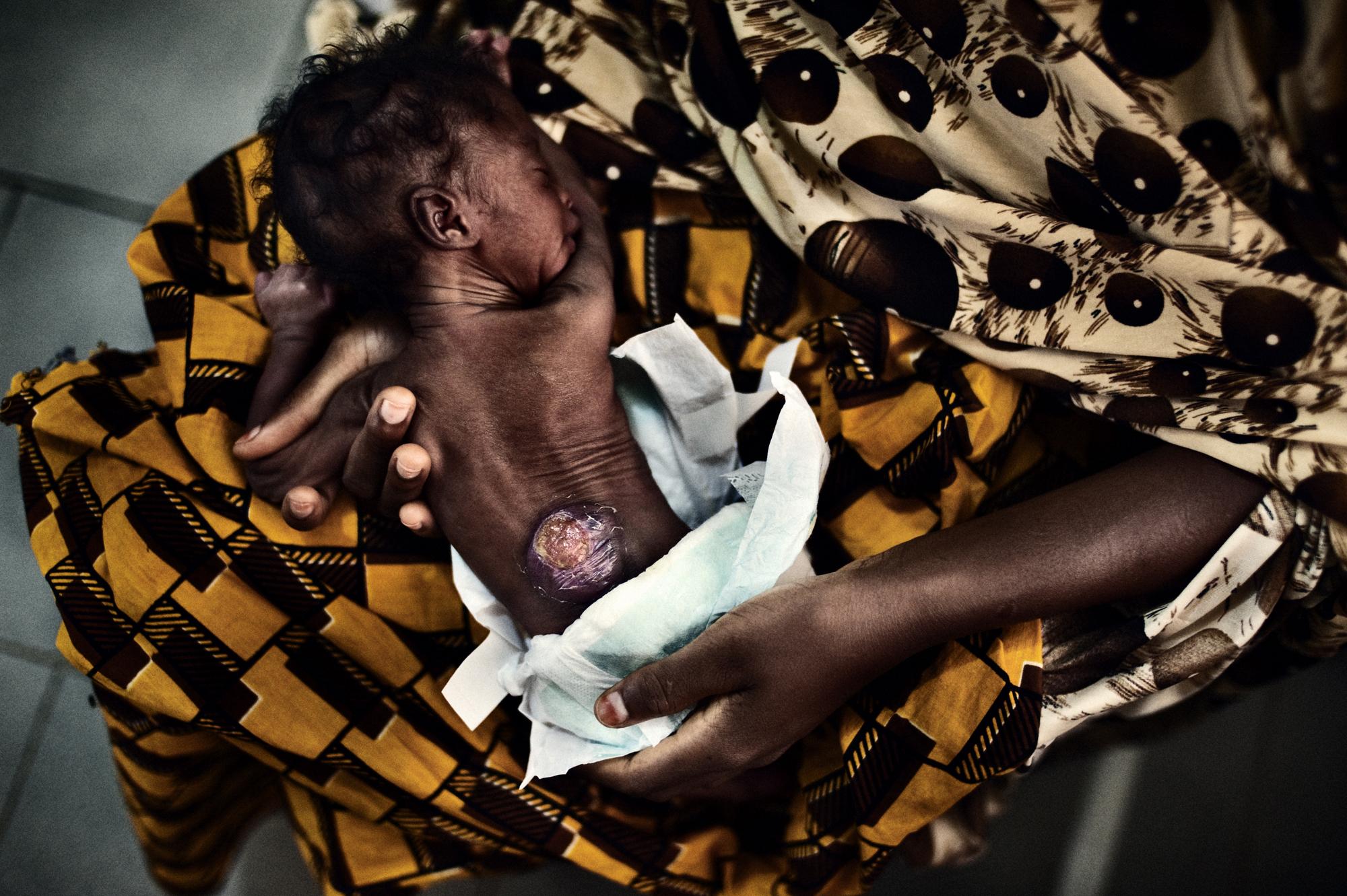 Child & maternal mortality - Nigeria, Katsina. October-November 2009. Turai Jaradua...