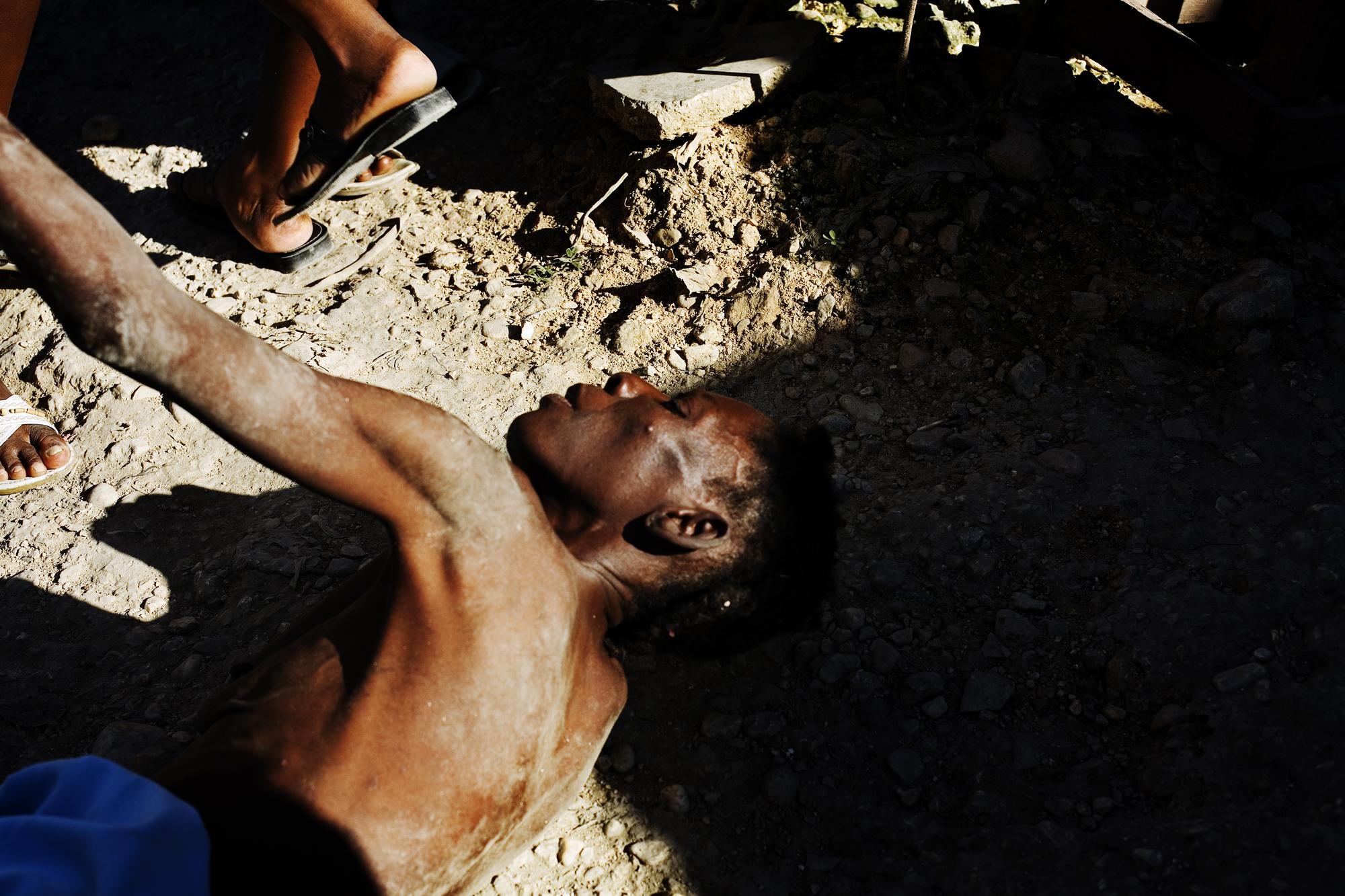 Haiti for MSF - HAITI Martissant, Port-au-Prince
A mentally ill woman...