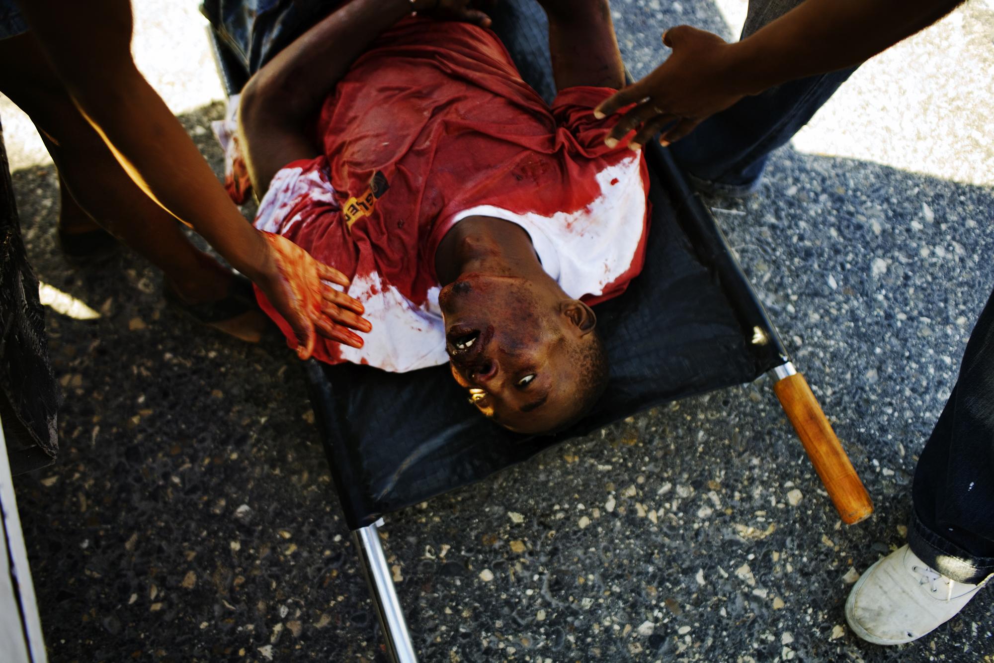 Haiti for MSF - HAITI Martissant, Port-au-Prince
A dying man in an MSF...