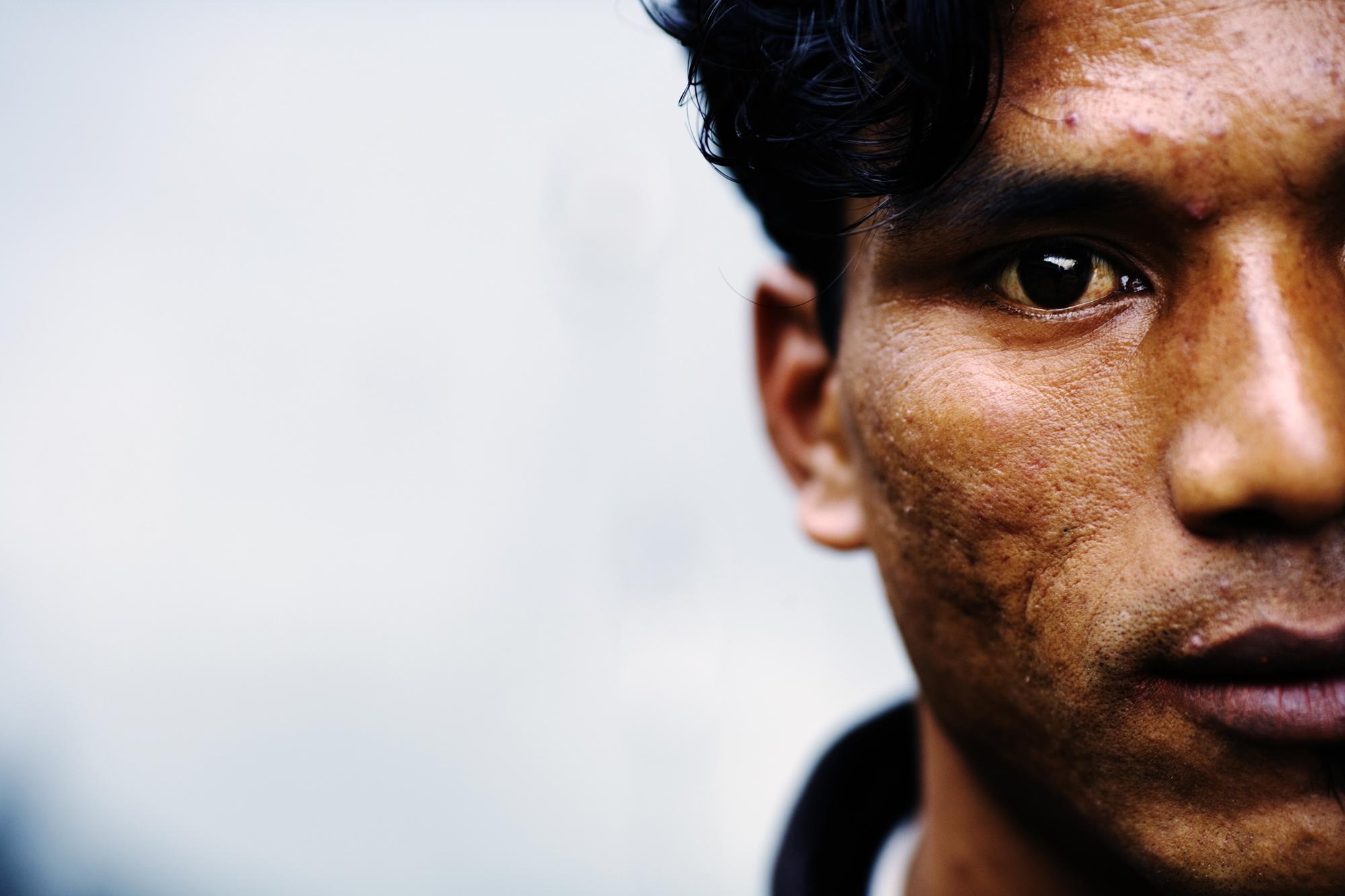 Injecting death - INDIA Shillong, Meghalaya A portrait of an inmate at the...