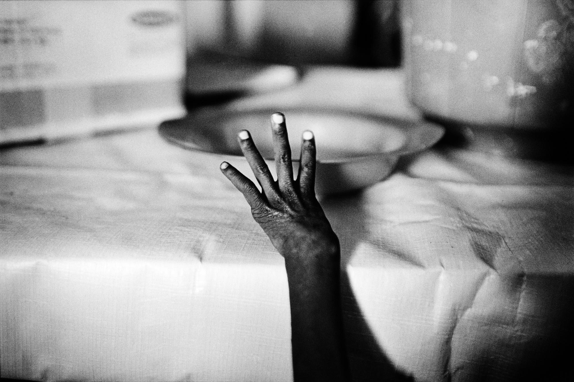 Somalia, the invisible trace - SOMALIA Huddur (Xuddur), Bakool A malnourished child in a...