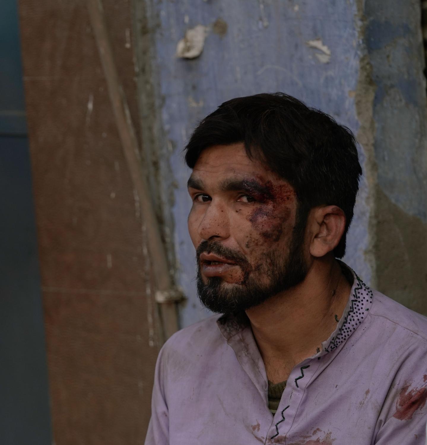 Aazadi - A Muslim man sits down after being beaten by far-right...